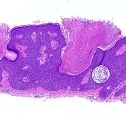 Consolidated Pathology Consultants - We have beautiful slides