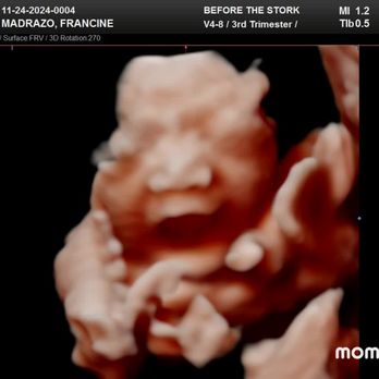 Before the Stork 4D - Ultrasound Imaging Centers Near Me - Anaheim, California