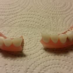 The Perio Group - Less than 2 years dentures broke in half. This should not happen after paying Dr. Berson $14,400!!!
