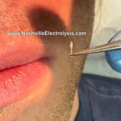 Nashville Electrolysis - Electrolysis by Lily Guzman L.E. ©