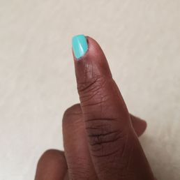 Cut finger Cut finger