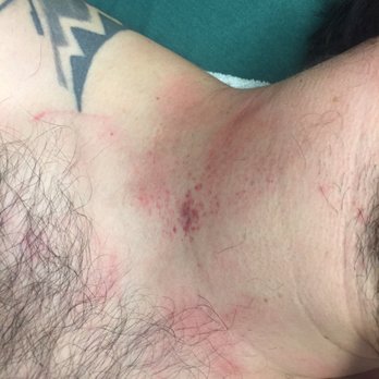 Q Nightclub - Assault from sumo-like bodyguard at Q. - Dance Clubs Near Me - Seattle, Washington Q Nightclub - Assault from sumo-like bodyguard at Q. - Dance Clubs Near Me - Seattle, Washington