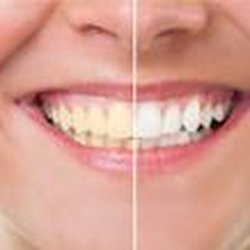 The Dental Care Center - The Dental Care Center - Greenville 3