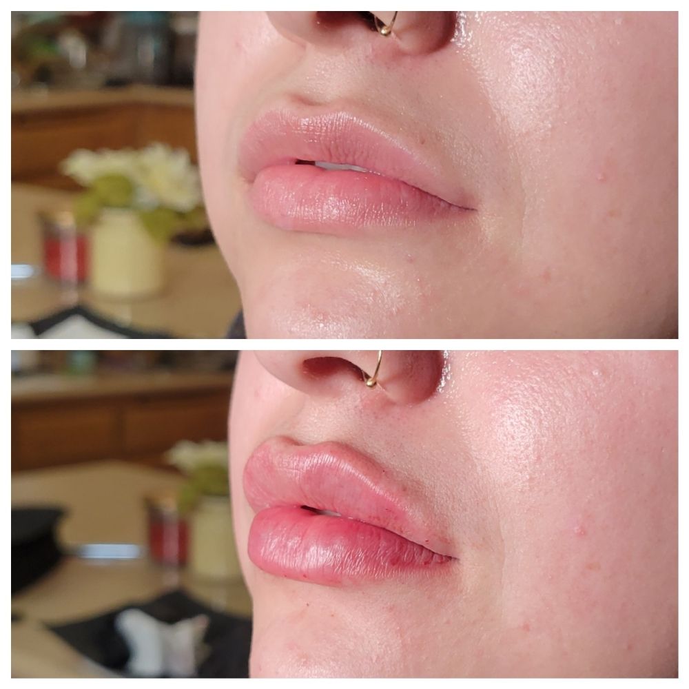 The Botox Spot Logo