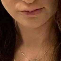 Healed lips Healed lips