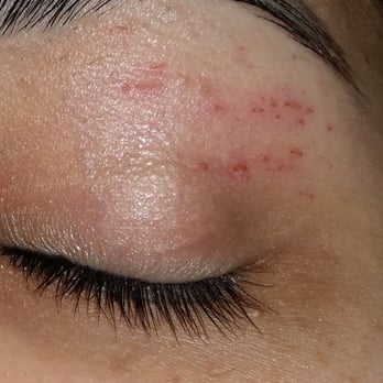 Eyebrow Hub - This is the next day. She really hurt me. - Eyebrow Services Near Me - Vallejo, California Eyebrow Hub - This is the next day. She really hurt me. - Eyebrow Services Near Me - Vallejo, California