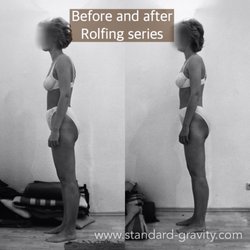Standard Gravity Rolfing & Bodywork - This client had "good" posture, but still improved with Rolfing. The head/neck angle shifted, ensuring better posture with age.