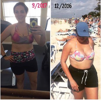 SPA After Lipo Care - Day Spas Near Me - Miami, Florida SPA After Lipo Care - Day Spas Near Me - Miami, Florida