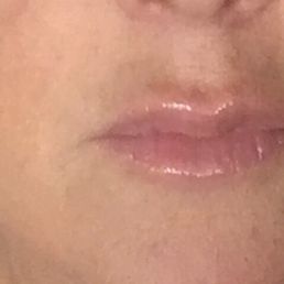 Love the results Love the results