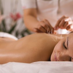 The Point of Healing - Acupuncture Sessions