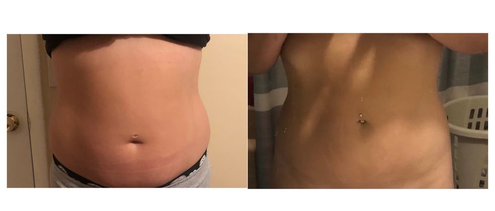 New Image Body and Face Contouring