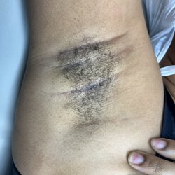 Unbare Me - Underarm Wax | BEFORE