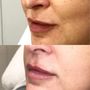 Photo of Contour You