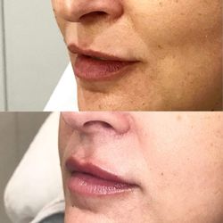 Contour You - Contour You