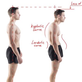 Trainologie - Correct Posture is necessary when pursuing weight lifting or any exercise routine involving load. Including your own body weight. - Trainers Near Me Trainologie - Correct Posture is necessary when pursuing weight lifting or any exercise routine involving load. Including your own body weight. - Trainers Near Me
