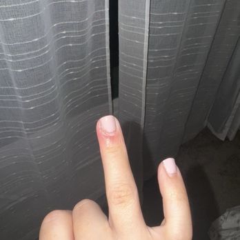 V's Nails Spa - This is my finger 3 weeks later - STILL INFECTED - Nail Salons Near Me - Irvine, California