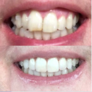 Etheridge Family Dentistry - Cosmetic Dentists Near Me - Seattle, Washington