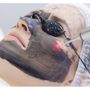 Photo of Bare Beaute Permanent Hair Removal by Electrolysis