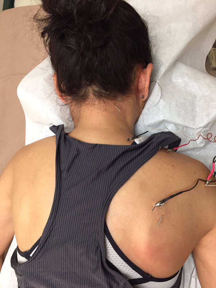 ACUMEN HEALTH CLINICS Updated August 2024 14 Reviews 2045 Royal Ave, Simi Valley