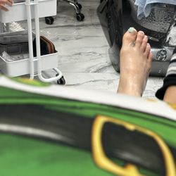Montana Nail - Big toe covered in gauze after Trish gauged it to the point of bleeding