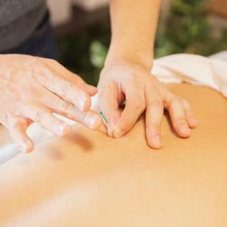 Brian Kirk Doty DD, LAc DACM - Glendora Acupuncture - Balance Your Body's Energy with #acupuncture #Therapy. (TCM)
