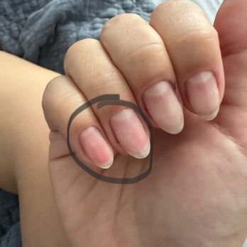 Tipsy Salonbar - My pinky nail is worse the my ring finger, but as you can see it's so red and thin. And obviously hurts - Hair Salons Near Me - Boynton Beach, Florida