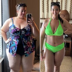 Concierge Medical Spa - Me when I weighed 329 lb ls and then 4 months after plastic surgery to have nearly 10 lbs of loose skin removed after losing 150 lbs.