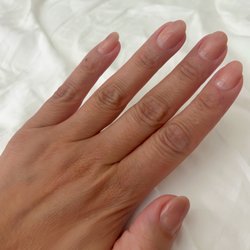 Today my nails are sooooo much better! So grateful!