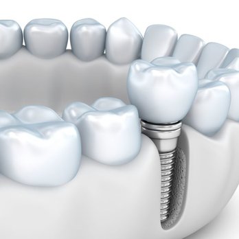 Redwood Dental Commerce - General Dentistry Near Me - Commerce Charter Twp, Michigan Redwood Dental Commerce - General Dentistry Near Me - Commerce Charter Twp, Michigan