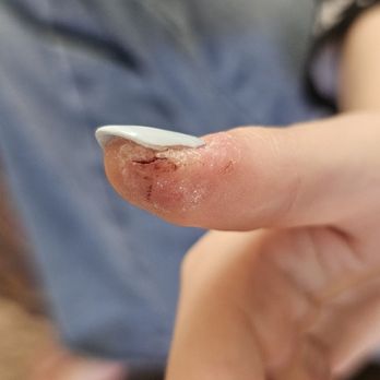 Mia Nail Spa - Deep cut on thumb - Nail Salons Near Me - Las Vegas, Nevada Mia Nail Spa - Deep cut on thumb - Nail Salons Near Me - Las Vegas, Nevada