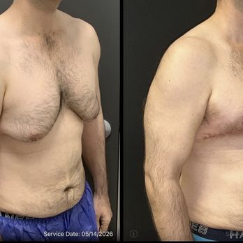 Charlie Chen, MD - Plastic Surgeons Near Me - San Diego, California Charlie Chen, MD - Plastic Surgeons Near Me - San Diego, California
