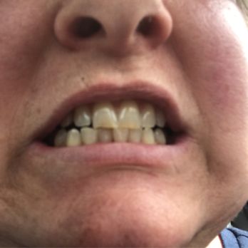 Allington Dental - General Dentistry Near Me - Amarillo, Texas