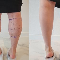 True Dermatology