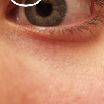 Diamond Lashes & Nails - When my lashes started to turn the wrong way. - Nail Salons Near Me - Whittier, California Diamond Lashes & Nails - When my lashes started to turn the wrong way. - Nail Salons Near Me - Whittier, California