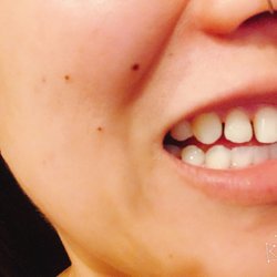 Nguyen Frank Hung T, DMD MSD - This is how my teeth get done.