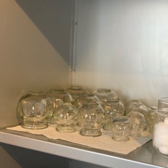 StillPoint Acupuncture Healing Arts - Glass Cupping - another option in addition to acupuncture - Acupuncture Near Me - Rochester, New York StillPoint Acupuncture Healing Arts - Glass Cupping - another option in addition to acupuncture - Acupuncture Near Me - Rochester, New York