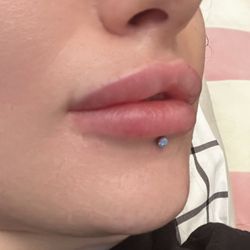 Isles of Beauty Med Spa - Lips