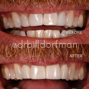 Bill Dorfman, DDS - Cosmetic Dentists Near Me - Los Angeles, California Bill Dorfman, DDS - Cosmetic Dentists Near Me - Los Angeles, California