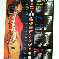 Spinal degeneration!