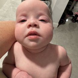 When the hospital told me that her eyes looked fine, this is what her face looked like When the hospital told me that her eyes looked fine, this is what her face looked like