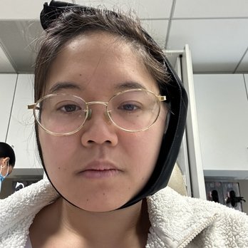 Merrifield Oral Surgery - Post-op (I do not remember taking this photo under anesthesia) - Oral Surgeons Near Me - Falls Church, Virginia Merrifield Oral Surgery - Post-op (I do not remember taking this photo under anesthesia) - Oral Surgeons Near Me - Falls Church, Virginia