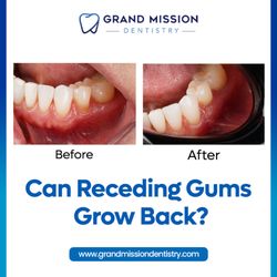 Grand Mission Dentistry - If your teeth look longer than before or feel sensitive near the gumline, your gums may be asking for help. Call () -