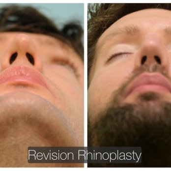 Lam Facial Plastics - Cosmetic Surgeons Near Me - Plano, Texas Lam Facial Plastics - Cosmetic Surgeons Near Me - Plano, Texas