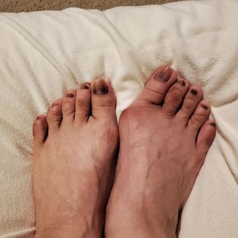 A.T. Beauty Spa - Here's my feet, she cut out all of my ugly nails that grown and now is so much better. No color, just my natural black. - Nail Salons Near Me - San Francisco, California A.T. Beauty Spa - Here's my feet, she cut out all of my ugly nails that grown and now is so much better. No color, just my natural black. - Nail Salons Near Me - San Francisco, California