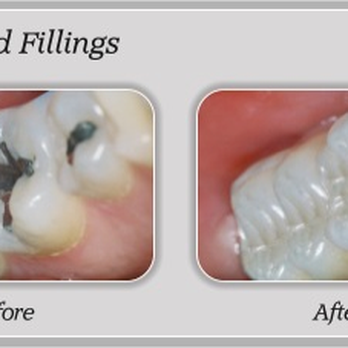 Anna K Choe, DDS - General Dentistry Near Me - Pasadena, California