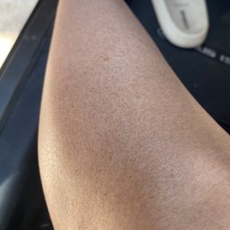 Spray tan Spray tan