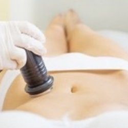 Fetch Figures - Destroy FAT cells permanently with ultrasounic sound waves