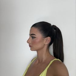 Center for Cosmetic Surgery: Sassan Alavi, MD - 4 months post op