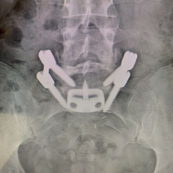 Dr. Luis Tumialán, M.D. - Posterior image - Doctors Near Me - Scottsdale, Arizona