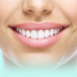 Monrovia Electrolysis - UPPER LIP